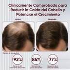 Excalvo  Crecimiento y Fortaleza