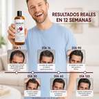 Excalvo  Crecimiento y Fortaleza